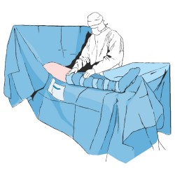 Matoset steril CSÍPŐMŰTÉT SZETT